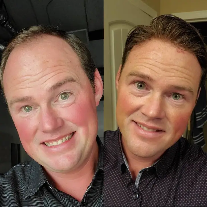 FLAS | Complément capillaire en Dentelle Française Top – Image 4