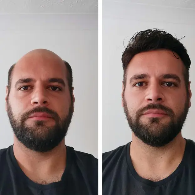 FLAS | Complément capillaire en Dentelle Française Top – Image 6