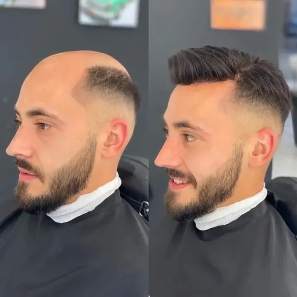 FSLE | Full Swiss Lace Hairpieces for Men - Image 7