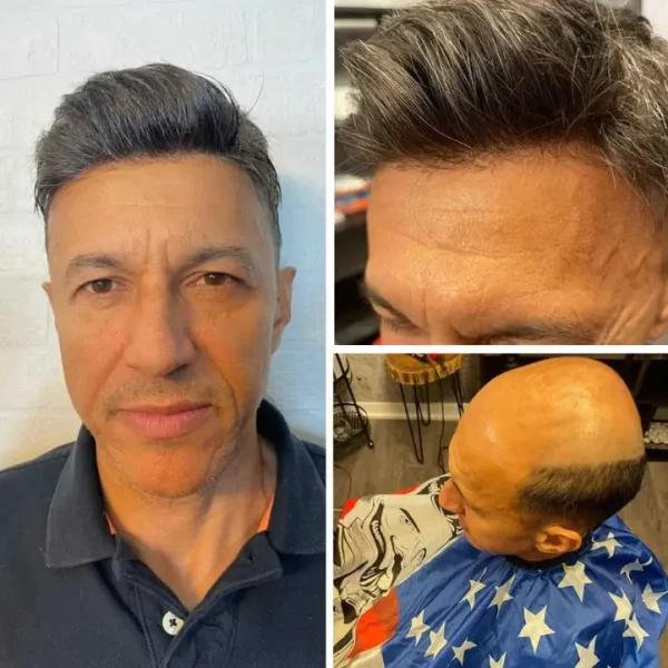 FLAS | French Lace Top with Thin Skin Perimeter Men's Hairpiece - Image 5