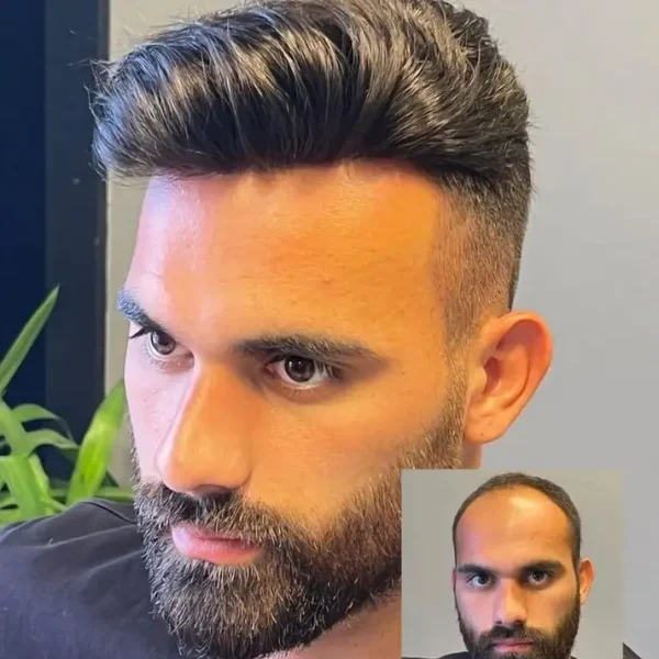 27+ | Fine Mono with Lace Front and Skin Hairpieces for Men - Image 6