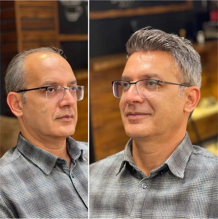 FFLE | Full French Lace Hairpieces for Men - Image 4