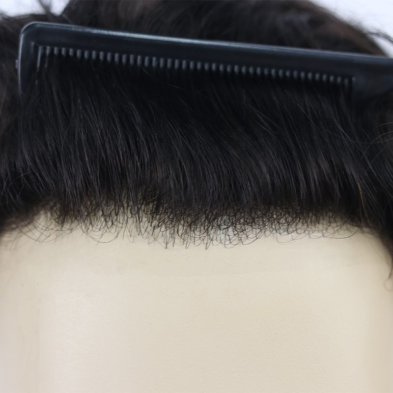 0.06mm Three Thin Skin Men’s Hair Systems - Image 2