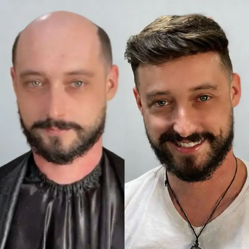 100% hand-ventilated for medical-grade breathability.